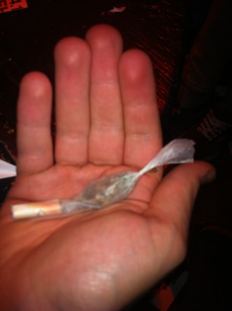 What our joints looked like back in 2010
